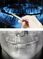 Zahnröntgen - Zahnarztpraxis Wien